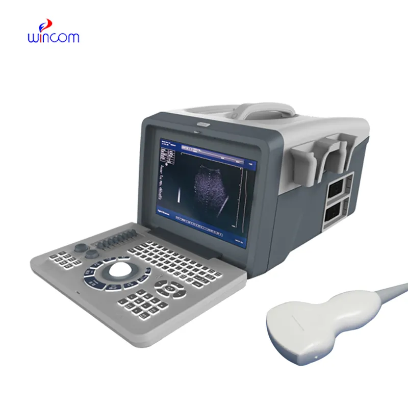 Digital Portable Ultrasound Scanner USS-218
