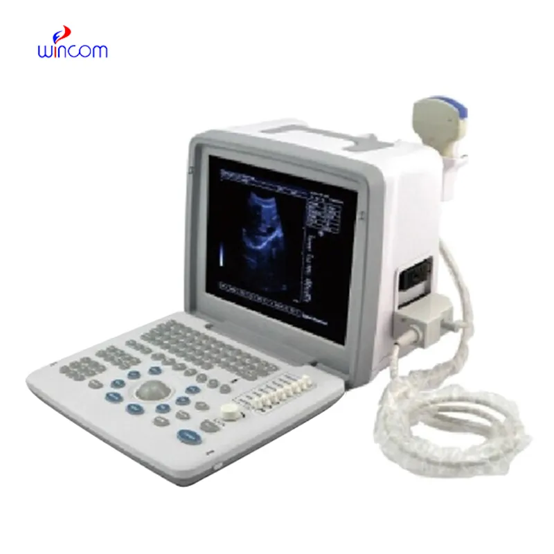 Full Digital Led Ultrasound Scanner USS-300