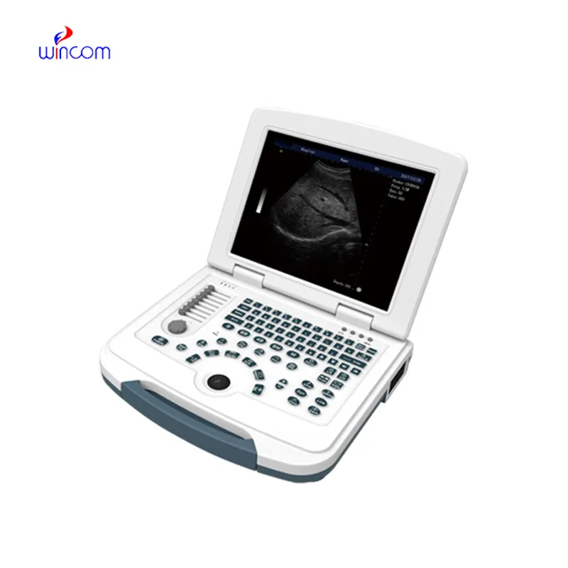 Notebook Digital Diagnostic Ultrasound System  USS-N580