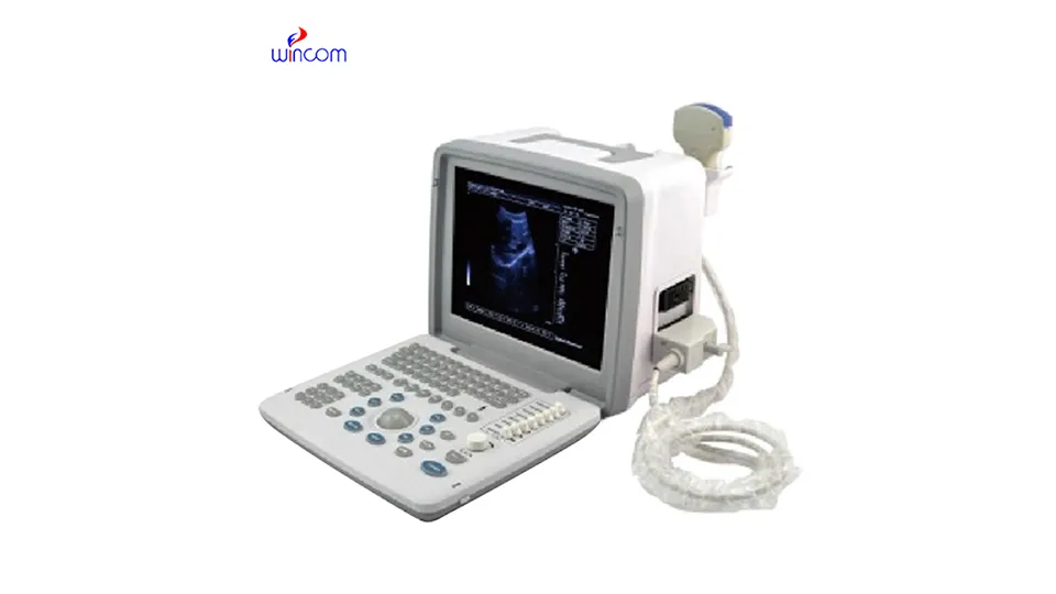 What diseases do you see in the B-ultrasound test?