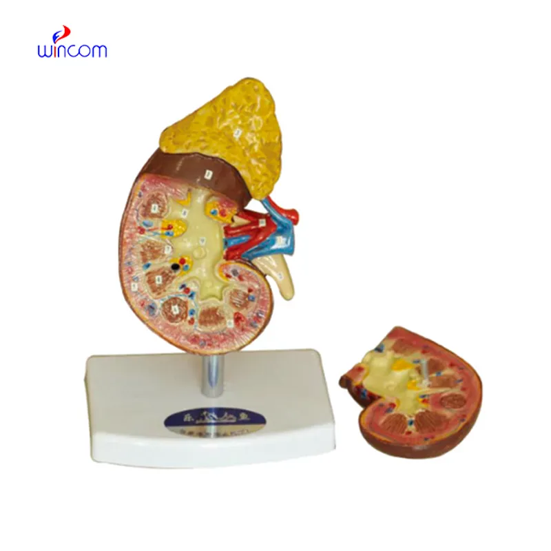 KIDNEY ADRENAL GLAND LM1132