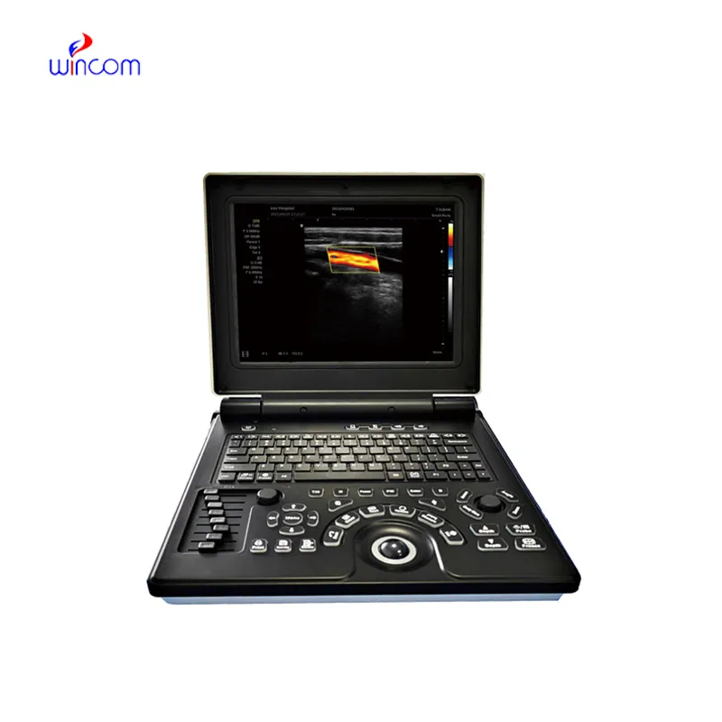 Laptop Color Doppler Ultrasonic Diagnostic System USS-N20C
