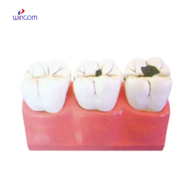 CARIES MODEL LM1108