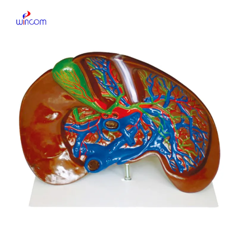 MODEL OF THE LIVER DISSECTION LM1081